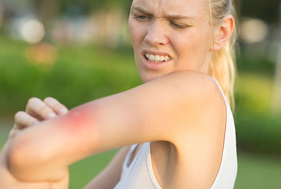 femme s'étant fait piquer le bras