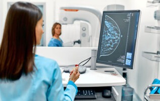 medecin depistage cancer du sein