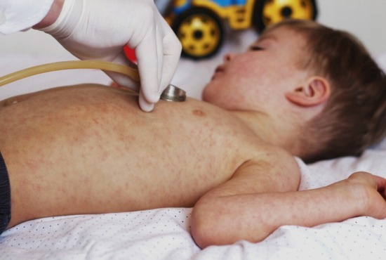 maladies orphelines