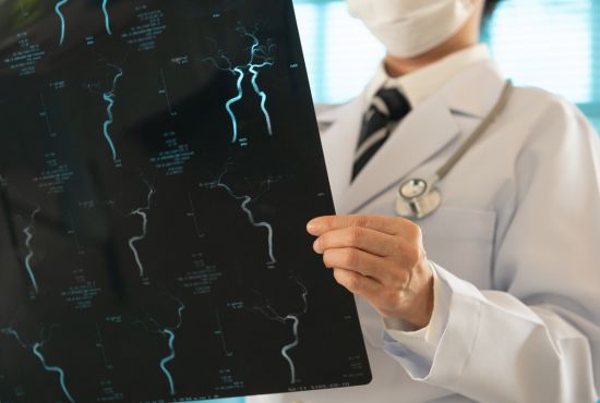 Un neurochirurgien qui recherche les vaisseaux sanguins d'un patient ayant une sténose