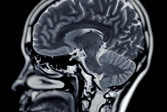 radio cerveau gilles de la Tourette