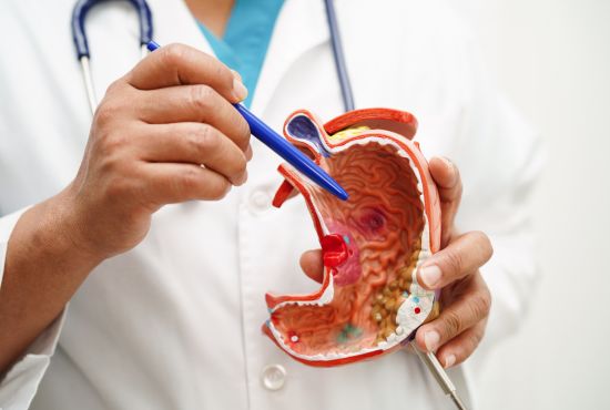 Professionnel de santé montrant une maquette de l'estomac pour expliquer le syndrome de dumping après une chirurgie bariatrique.
