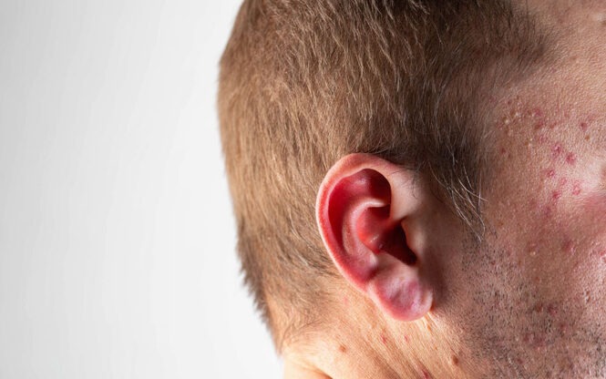 effets de l'alcool sur la peau